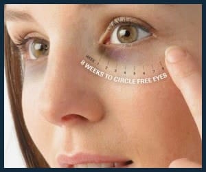 blepharoplastie