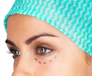 blepharoplastie